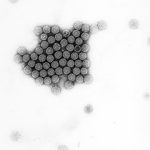 Electron-microscopical image of human papilloma viruses - Source: DKFZ, Prof. Hanswalter Zentgraf