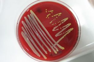 Arbeiten mit Bakterien
