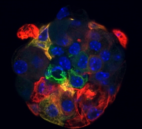 Thymus-Stammzellen wachsen in der Kulturschale zu kugeligen Gebilden heran, den Thymosphären. Darin differenzieren sich die medullären (grün) und die kortikalen (rot) epithelialen Thymozyten.