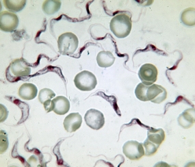 Bild: Afrikanische Trypanosomen, die Erreger der Schlafkrankheit, im Blutausstrich