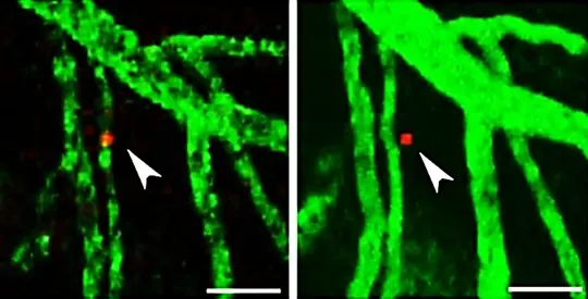 Mit einer speziellen Mikroskopie-Technik können Wissenschaftler einzelne Lymphomzellen (rot gefärbt) im lebenden Gehirn einer Maus über längere Zeit mitverfolgen. Nach 24 Stunden ist die Lymphomzelle aus dem Blutgefäß ins Hirngewebe eingewandert (rechts).