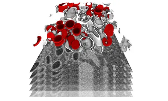 Infizierte Zellen wurden mittels fokussierter Ionenstrahl-Rasterelektronenmikroskopie abgebildet. In diesem Bild wurde ein Subvolumen einer Zelle segmentiert, um membrangebundene Organellen (grau) und Doppelmembran-Vesikel (rot) darzustellen – ein virusspezifisches Kompartiment, in dem das virale Genom in großen Mengen vervielfältigt wird.