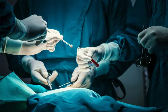 Chirurgische Hände, die sorgfältig mit Instrumenten an einem Patienten arbeiten. Es sind mehrere Personen in OP-Kleidung zu sehen, die präzise Eingriffe vornehmen. Die Szene vermittelt einen Eindruck von Professionalität und Teamarbeit in einem chirurgischen Umfeld.