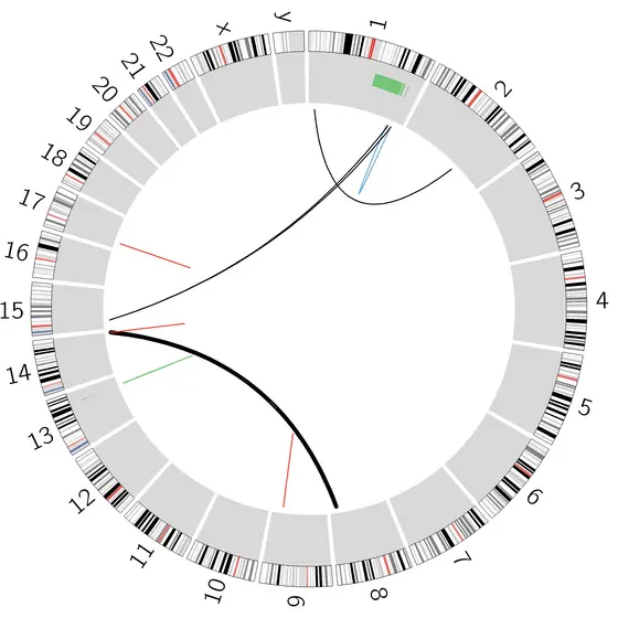 Veränderungen im Genom eines Burkitt-Lymphoms. Neben der so genannten Burkitt-Translokation zwischen Chromosom 8 und Chromosom 14 (dicke schwarze Linie) weist das Genom weitere Veränderungen auf: Material wird ausgetauscht zwischen zwei Chromosomen (Translokation) (schwarz), umgedreht (Inversion) (blau), zusätzlich eingeschoben (Insertion) (grün) oder entfernt (Deletion) (rot) auf.