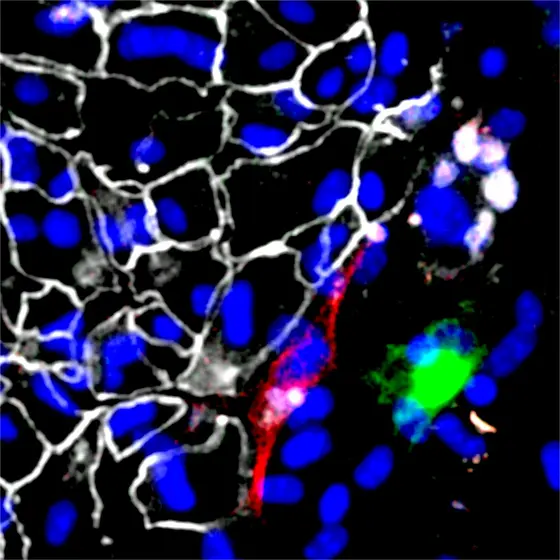 The image displays a microscopic view of cellular structures. Key features include blue nuclei, a network of white cell outlines, and distinct red and green areas, suggesting various biological activities or interactions within the tissue. This illustrates cellular organization and potential processes relevant to medical research.