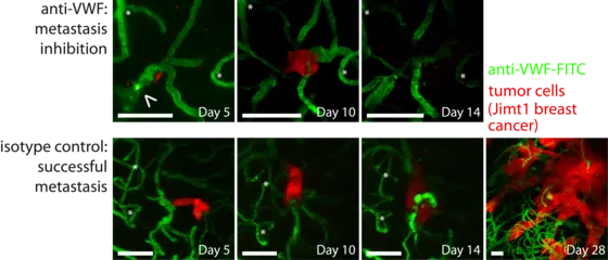 Pictures in the upper row: Inhibition of a blood clotting factor (von Willebrand factor) with specific antibodies reduces the formation of brain metastases (stained red) in mice.