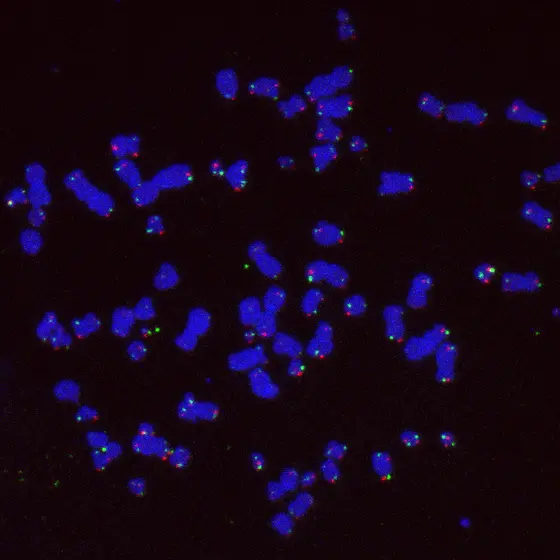 Chromosomen einer Tumorzelle, die ihre Telomere (pink und grün) auf dem alternativen Weg verlängert