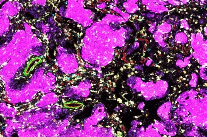 Mikroskopische Ansicht einer Probe, die vorwiegend in lebhaften Lila- und violetten Farbtönen dargestellt ist. Die Struktur zeigt verschiedene organische Formen und Texturen, die auf zelluläre oder gewebliche Elemente hinweisen. Es gibt auch Stellen in Grün und anderen Farben, die zusätzliche Details bieten.