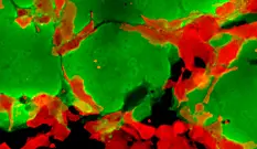 Upon infection with CD133-specific measles viruses, CD133-positive tumor cells (green) die off, leaving only holes in the cell layer after a few hours. Even directly adjacent CD133-negative cells (red) are protected from infection.