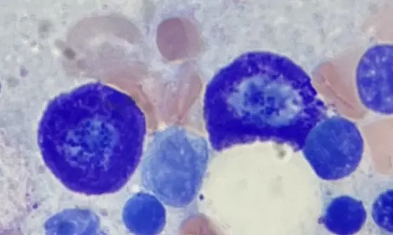 Mast Cells
