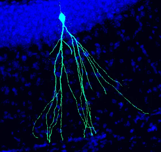 Newborn neuron in the brain of an adult mouse.
