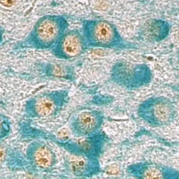 Dopamin-produzierende Nervenzellen im Mäuse-Gehirn. Der Zellkern ist hellbraun, darin sind die Kernkörperchen als kleine, runde, dunkelbraune Strukturen zu erkennen.