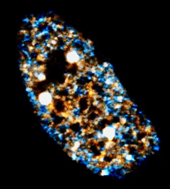 Zellkern einer Sarkomzelle. Das Protein SS18-SSX (weiß) dockt an die Erbsubstanz im Zellkern an und aktiviert somit Gene, die an der Krebsentstehung beteiligt sind.