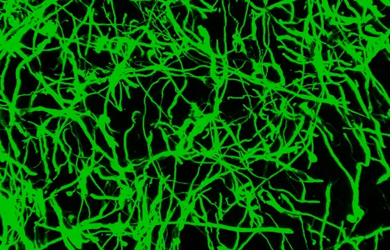 Vernetzte Tumorzellen aus Glioblastomen (grün) lassen sich anhand ihrer Genaktivität von anderen Zellen des Tumors unterscheiden.