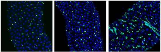 Sexualhormone steigern die Gefahr, dass onkogene Mutationen Tumoren auslösen: Mitte: Darmstammzellen mit einer krebstreibenden Mutation (grün), rechts: dieselben Zellen unter Einfluss des Sexualhormons