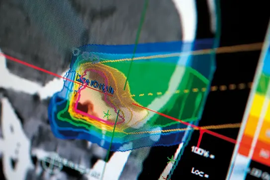 Das Bild zeigt eine digitale Darstellung einer medizinischen Analyse, vermutlich aus einer Bildgebung oder Strahlentherapie. Es sind farbige Konturen und Linien zu sehen, die unterschiedliche Bereiche und die Verteilung von Strahlendosen darstellen.