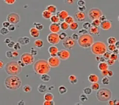 Cancer Cells die from Ferroptosis