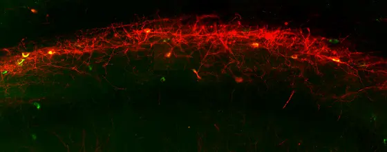 Fluoreszenzaufnahme eines Schnittes eines Mäusehirns. Gezeigt wird die Injektionsstelle im Hippocampus, mCherry in rot, Somatostatin in grün dargestellt.