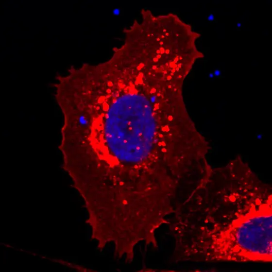 Die Behandlung mit dem Inhibitor bringt den mutierten FLT3-Rezeptor (rot) wieder an die Zelloberfläche.