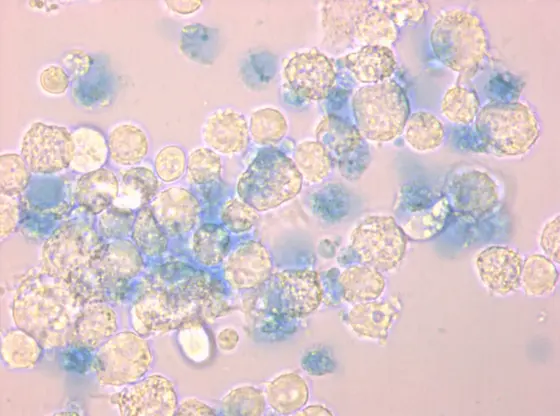 Phagocytic cells in contact with apoptotic cells dyed blue