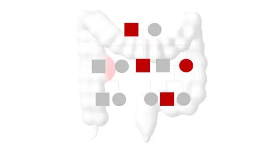 Lynch syndrome is a hereditary predisposition to early-onset colorectal cancer