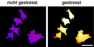 Mit dem Biosensor ausgestattete menschliche Krebszellen zeigen eine unterschiedliche Fluoreszenz vor (links) und nach (rechts) der Entwicklung von oxidativem Stress. Eichmarke: 20 µm.