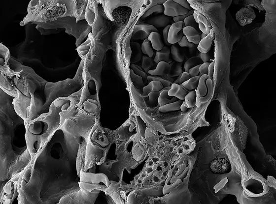 Blutgefäße der Lunge