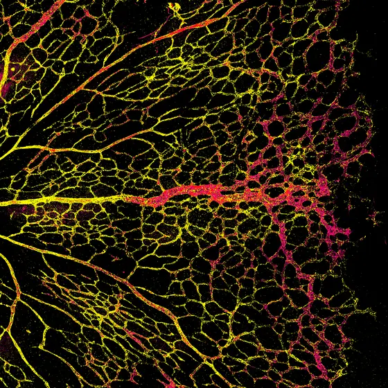 Ausschnitt aus einer Netzhaut: Die Blutgefäße sind gelb gefärbt, das Bindeprotein SYNJ2BP pink. Letzteres ist hauptsächlich in den neuen Gefäßzellen (rechts) vorhanden, jedoch kaum in den Tip-Zellen an der Spitze.
