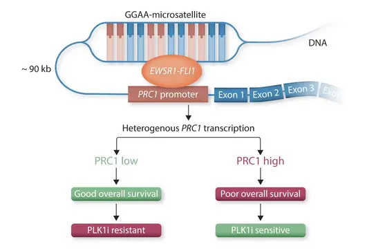 Diese Abbildung zeigt das Wechselspiel zwischen dem EWSR1-FLI1-Fusionsprotein und dem PRC1-Gen, das die Überlebensraten bei bestimmten Kindheitskrebsarten beeinflusst. Bei niedriger PRC1-Expression ist die Überlebensrate gut; bei hoher PRC1-Expression ist die Erkrankung PLK1-empfindlich und hat eine schlechte Prognose.