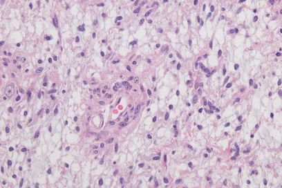 Mikroskopische Aufnahme von Gewebe mit zahlreichen Zellen. Die Zellen sind unterschiedlich gefärbt, mit lila und rosa Tönen, und zeigen ein dichtes Netzwerk mit verschiedenen Zelltypen und Zwischenräumen.