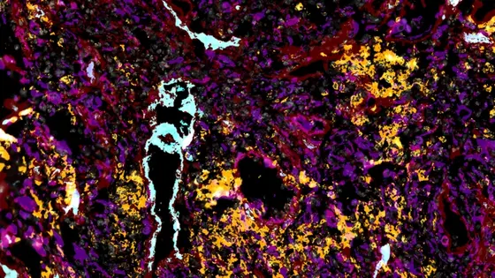 Abstract image featuring a vibrant, textured background composed of swirling patterns in purple, red, orange, and black. Bright areas in turquoise and white create striking contrasts against the darker tones, evoking an energetic and dynamic visual experience.