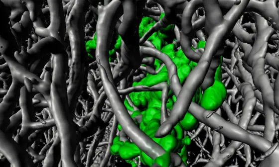 Mikrometastase im Gehirn einer Maus (grün), umgeben von einem dichten Netzwerk an Blutgefäßen (grau).