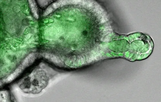 Ein Darm-Organoid wächst in einer dreidimensionalen Matrix und zeigt ein krebsauslösendes Wachstumssignal (ERK) als grüne Fluoreszenz im Zellkern. Die Zellkerne von Kryptenzellen (rechts) zeigen hohe Aktivität, während differenzierte Epithelzellen (links) niedrige Aktivität aufweisen.