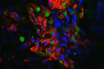 Mikroskopische Aufnahme von Zellen mit einer Vielzahl von Farben. Es sind rote, grüne und blaue Zellen zu sehen, die in einer unregelmäßigen Anordnung angeordnet sind. Der Hintergrund ist dunkel, was die Farbkombination hervorhebt. Die Aufnahme suggeriert ein biologisches oder medizinisches Thema.