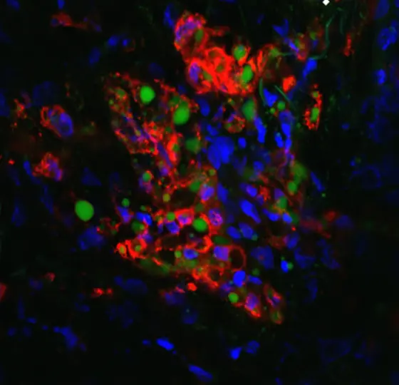 Mikroskopische Aufnahme von Zellen mit einer Vielzahl von Farben. Es sind rote, grüne und blaue Zellen zu sehen, die in einer unregelmäßigen Anordnung angeordnet sind. Der Hintergrund ist dunkel, was die Farbkombination hervorhebt. Die Aufnahme suggeriert ein biologisches oder medizinisches Thema.