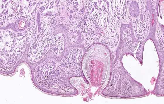 Gewebe eines Pigmentmals