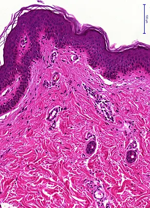 Histologisches Bild der Haut (