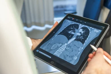 Thoraxdiagnostik Radiologie