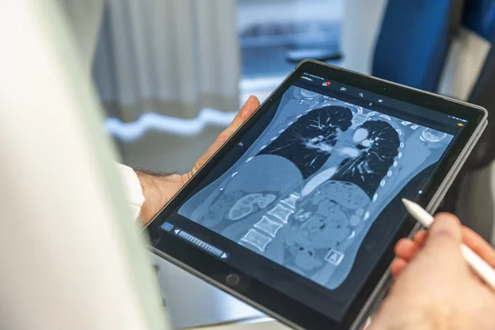 Thoraxdiagnostik Radiologie