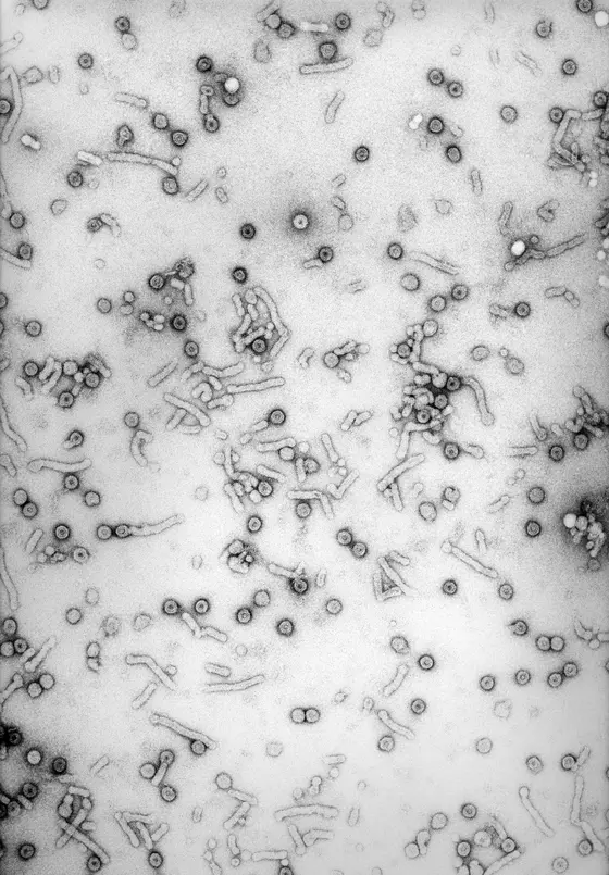 Elektronenmikroskopische Aufnahme von Hepatitis B-Viren.