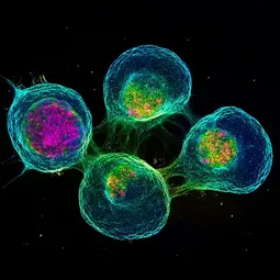 Stammzellen generieren die andere Zellen, aber mutierte Stammzellen Krebs verursachen können.