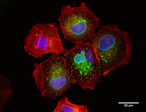 The breast cancer cell line MCF7 produces the microprotein CASIMO1 (green). Shown in red is the cytoskeleton protein actin, the cell nuclei appear blue.