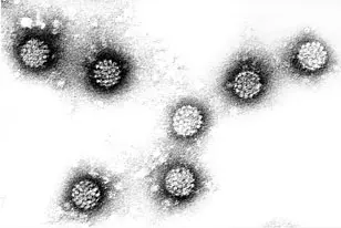 Electron micrograph of human papilloma viruses (Hanswalter Zentgraf, German Cancer Research Center)