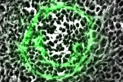 The image shows a microscopic view of cellular structures, featuring a distinct circular pattern highlighted in green, surrounded by dark, irregularly shaped cells. The contrast emphasizes the outline and texture of the central structure within the cellular environment.