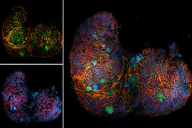 Organoids IF bild