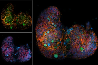 Organoids IF bild