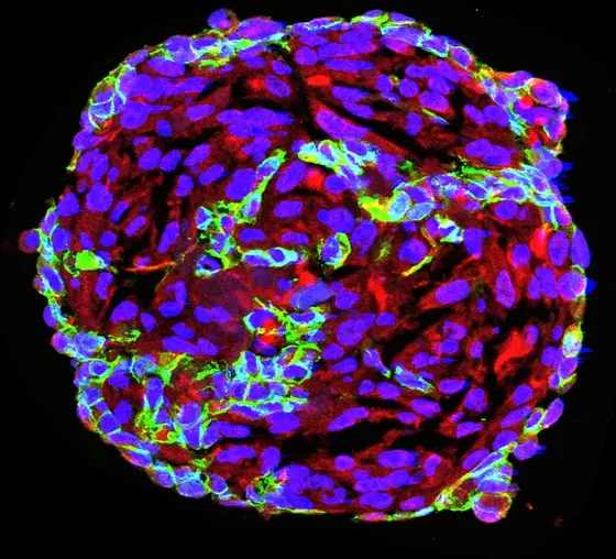 Werden Endothelzellen (grün gefärbt) und Perizyten (rot gefärbt) gemeinsam in der Kulturschale herangezogen, so bilden sie kugelartige Spheroide, an denen die Wechselwirkungen der beiden Zelltypen in 3D untersucht werden können.