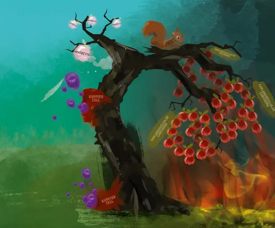 The artistic illustration depicts the role of reactive oxygen species, TNF, and JNK in the formation of liver malignancies - hepatocellular carcinoma or intrahepatic cholangiocarcinoma.