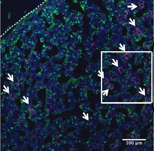 In bone sections a strong increase in the number of polyploid megakaryocytes (red cells) was observed after treatment of mice with IFN