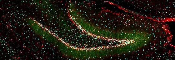 Generation of new neurons in the hippocampus of mice. DBI (Diazepam binding inhibitor) is dyed red, the two stem cell markers nestin and SOX2 are dyed green and cyan, respectively.